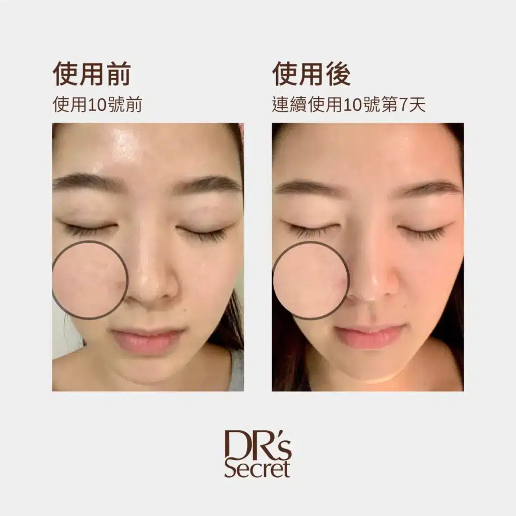 yi wen before and after using aqua boost serum 2